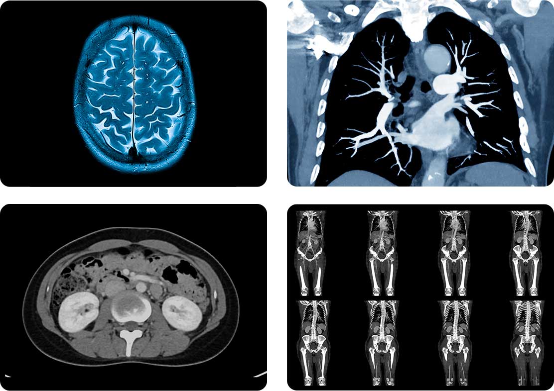 CT scan images