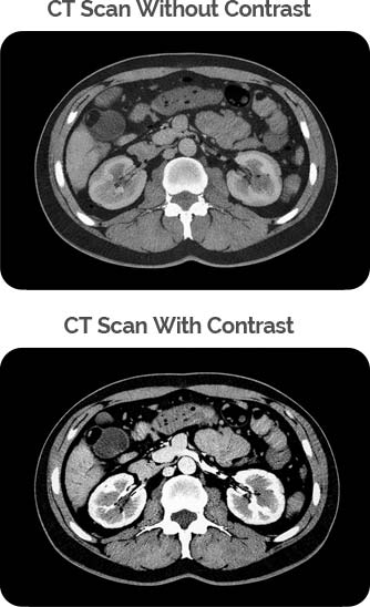 Contrast free CT vs with contrast