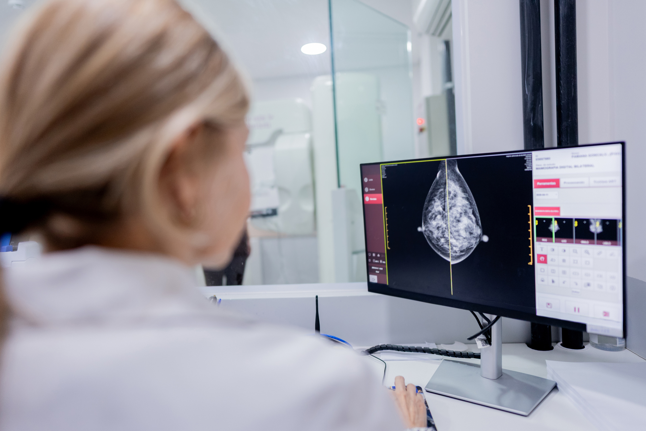 Doctor examining mammography scan on hospital computer